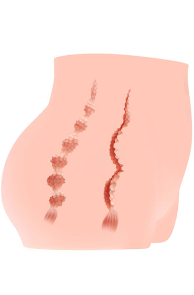 Kokos Cherry Masturbator 3kg - Sexpuppe 3