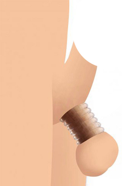 Master Series Ring Master Custom Ball Stretcher Kit - Ball Stretcher 1